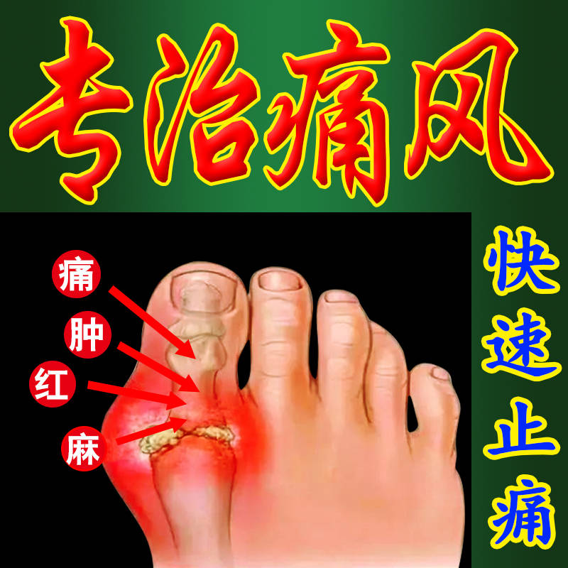 10g痛风克星痛风骨痛灵痛风膏痛风贴膏药尿酸高痛风止痛专治痛风专用