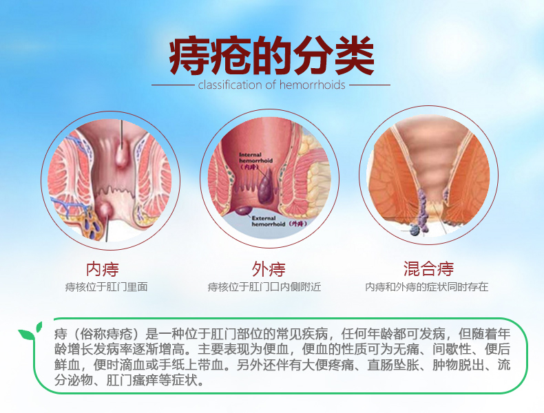 痔疮栓要塞图片