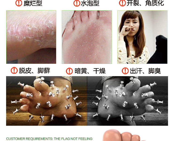 脚气奇痒臭汗症足光散乳膏一擦见效买2送1